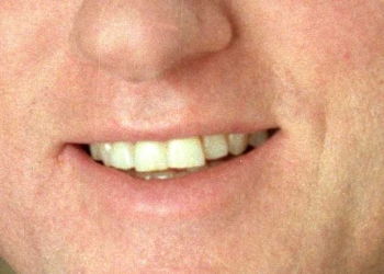 ביקור קלינטון, פרק 2: חברים יש רק בנובל