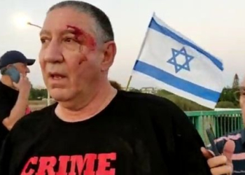 המפגין שנפצע בגשר | צילום: מתוך הרשתות החברתיות, באישור המצולם