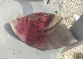 הכובע של חייל המילואים יובל בן ארי, שנרגם באבנים על ידי מתנחלים בתקופת המסיק | צילום: יובל בן ארי