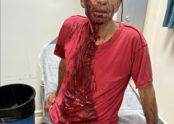 עודד ידעיה אחרי הפציעה | שימוש לפי סעיף 27 א׳ לחוק זכויות יוצרים