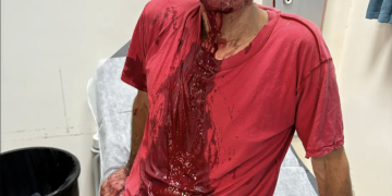 עודד ידעיה אחרי הפציעה | שימוש לפי סעיף 27 א׳ לחוק זכויות יוצרים